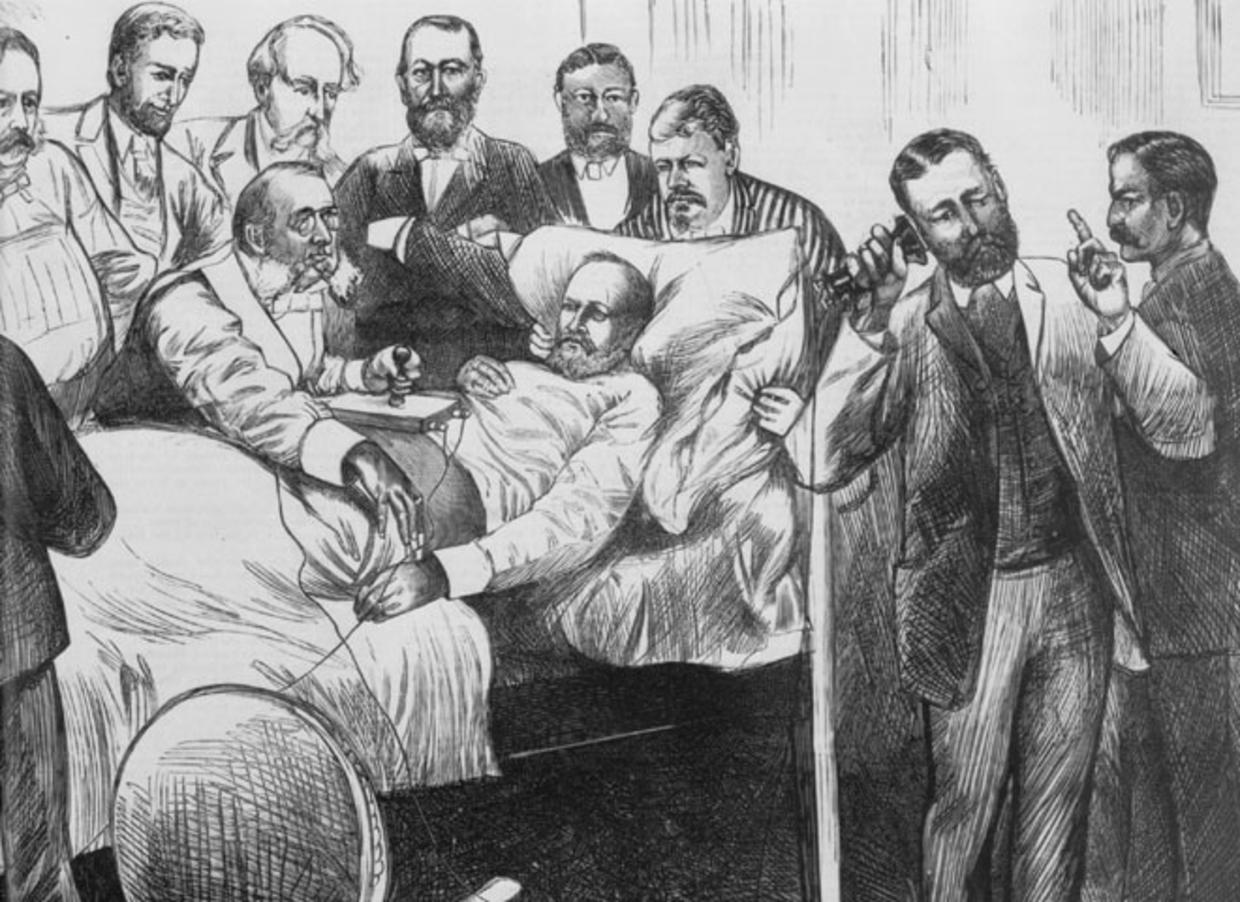 Dr. D. Willard Bliss summons Alexander Bell to use his induction-balance device to locate the assassin's bullet, which is something of a metal detector device; unbeknownst to them all, is that Garfield's mattress was lying on top of metal springs, which were uncommon at that time. After 80 days of suffering, he died from infection from the gunshot wound. The D. in the Dr. Bliss' name stands for Doctor, given as his first name at birth.